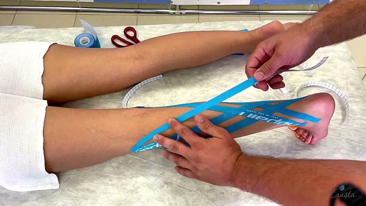 Кинезиотейпирование голени, лимфодренаж, обучение реабилитологов c Вячеславом Реутом, Лауста, АВАР