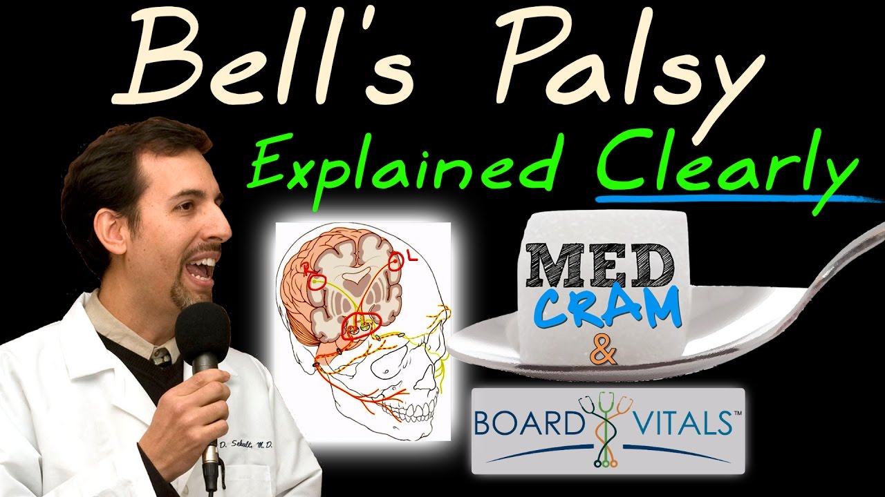 Bell's Palsy Explained Clearly - Exam Practice Question