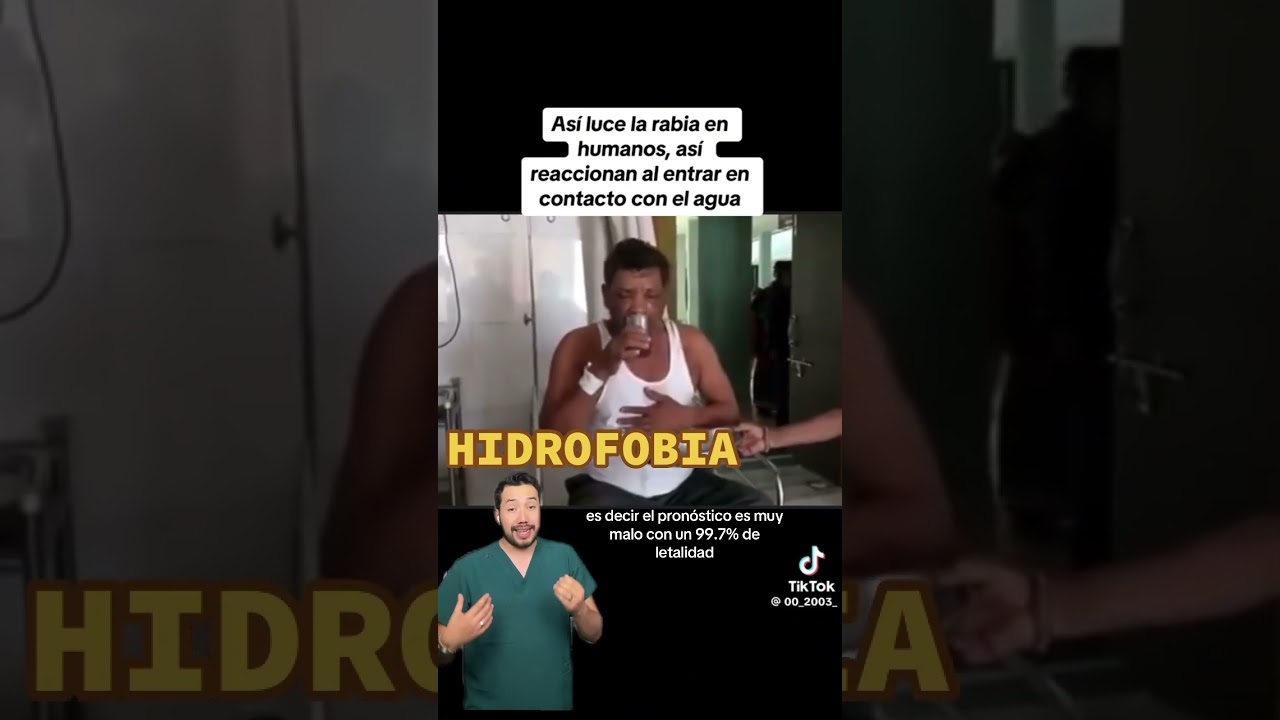 AS&Iacute; SE VE LA RABIA EN HUMANOS | HIDROFOBIA POR VIRUS DE LA RABIA #internista #medico