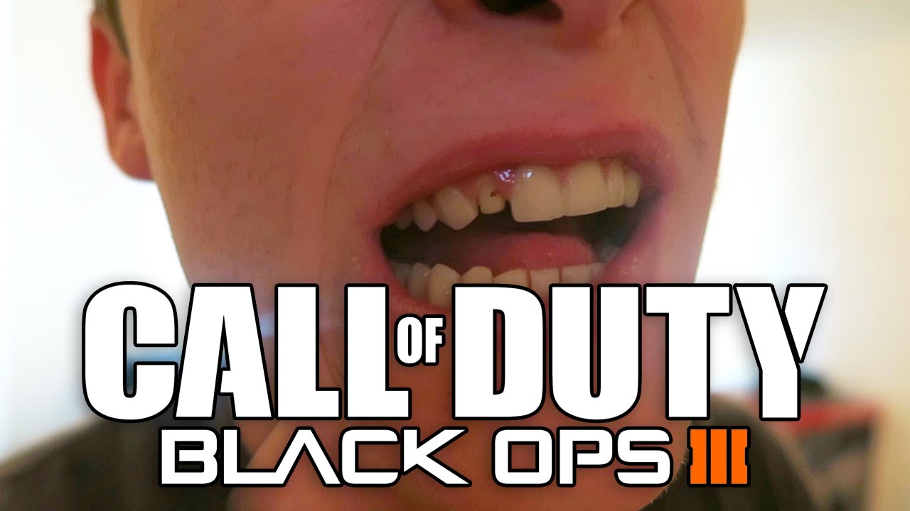 I Lost a Tooth Playing Black Ops 3
