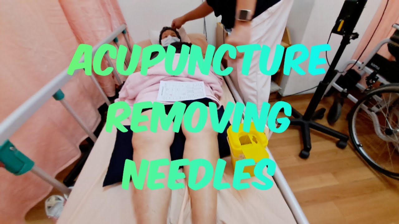ACUPUNCTURE REMOVING NEEDLES