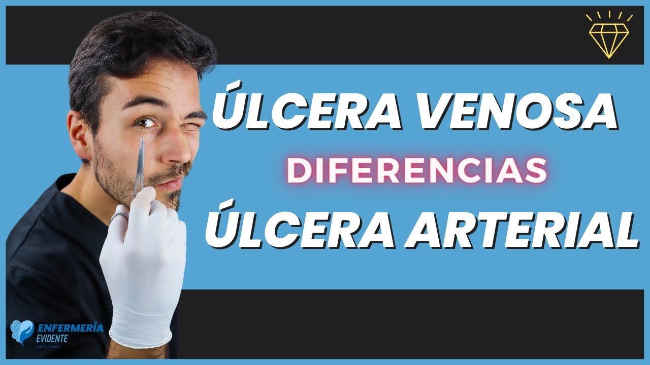 🔍¿Cómo DIFERENCIAR una ÚLCERA Venosa de una Arterial? [ ETIOLOGÍA ]✔️