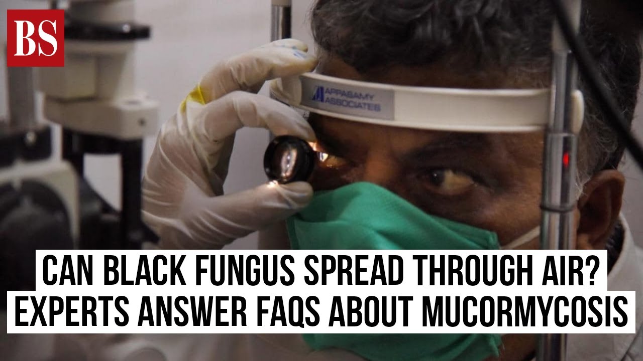 Can Black Fungus spread through air? Experts answer FAQs about mucormycosis