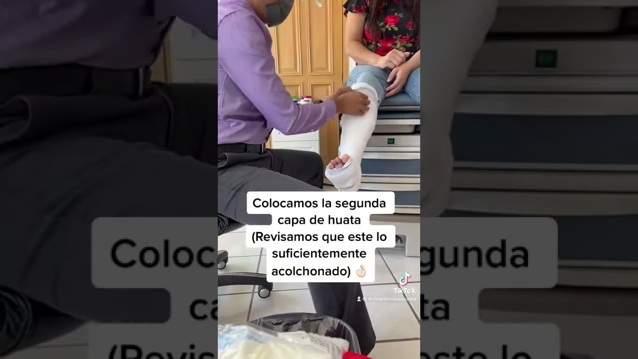 Inmovilización por fractura en metatarsiano con fibra de vidrio ✅