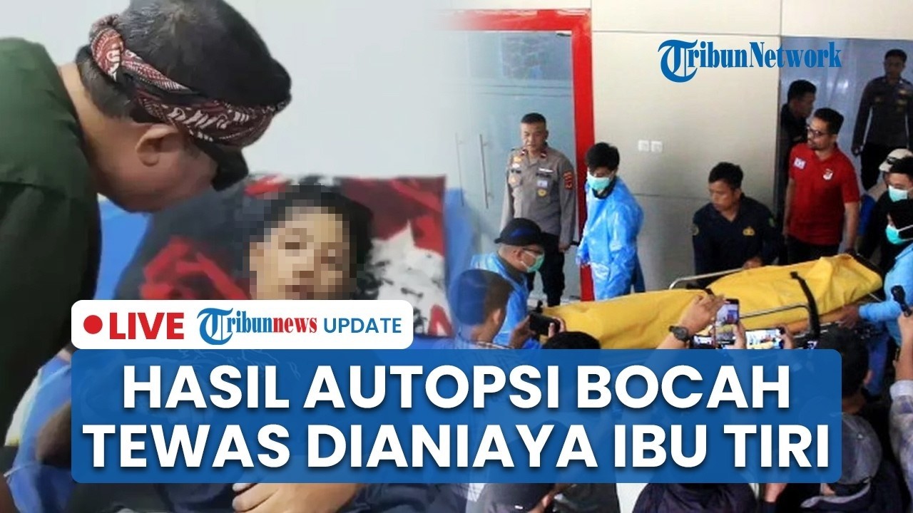 🔴LIVE: Autopsi Kematian Bocah Tewas Dianiaya Ibu Tiri di Sukabumi Terungkap, Polisi Periksa 16 Saksi
