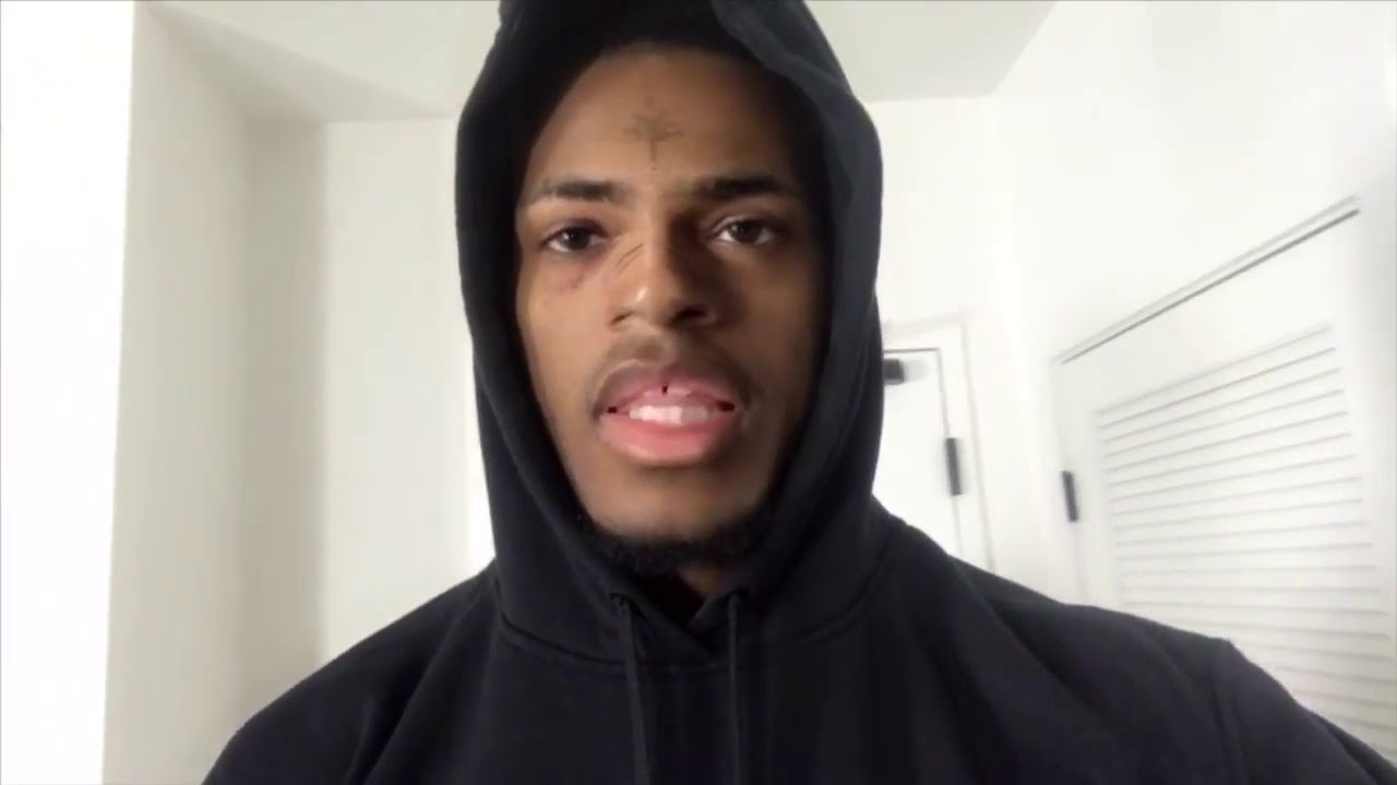 Elisocray Xxxtentacion New Video Cringe
