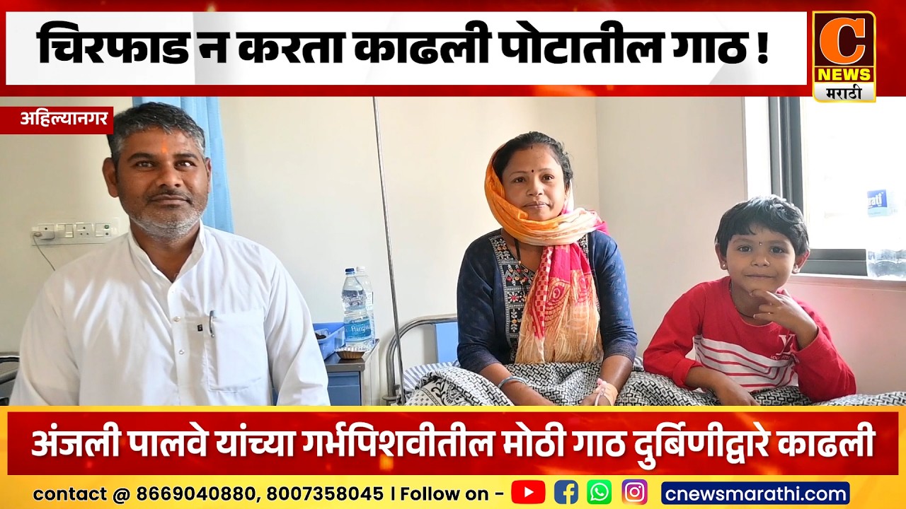 अहिल्यानगर - चिरफाड न करता काढली पोटातील गाठ ! साताळकर लोटस सुपर स्पेशालिटी हॉस्पिटलची किमया