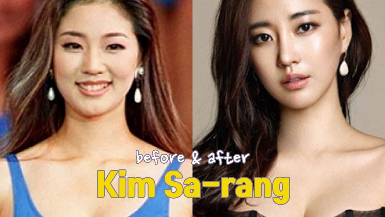 Kim Sa-rang before and after