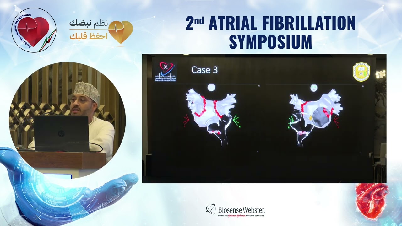 Rhythm vs Rate control - Dr. Mohamed AlRawahi