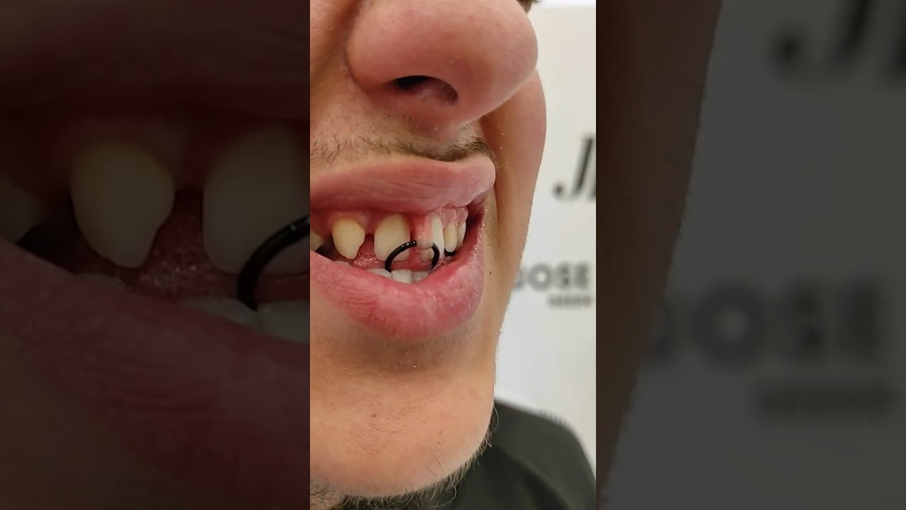 He Pierced WHAT In His Mouth?!