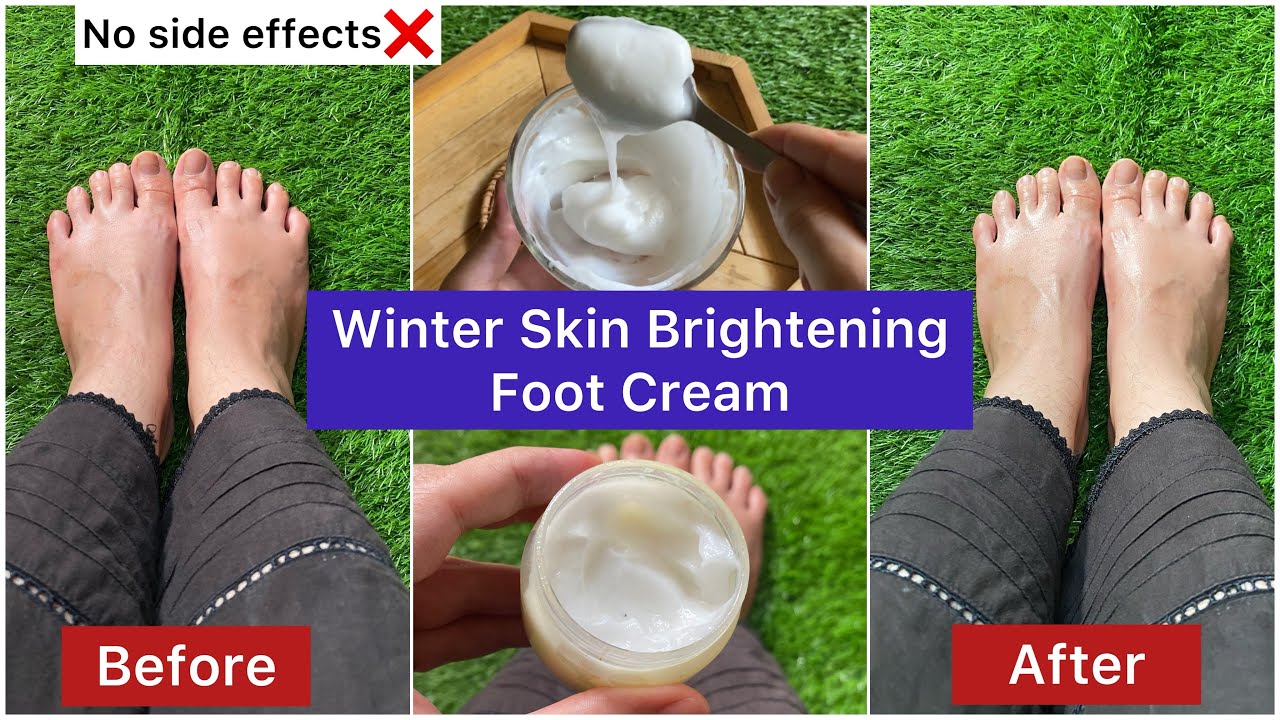 Make Your Own Foot Whitening Cream For Bright.Soft & Beautiful Feet | DIY foot cream for winter 2023
