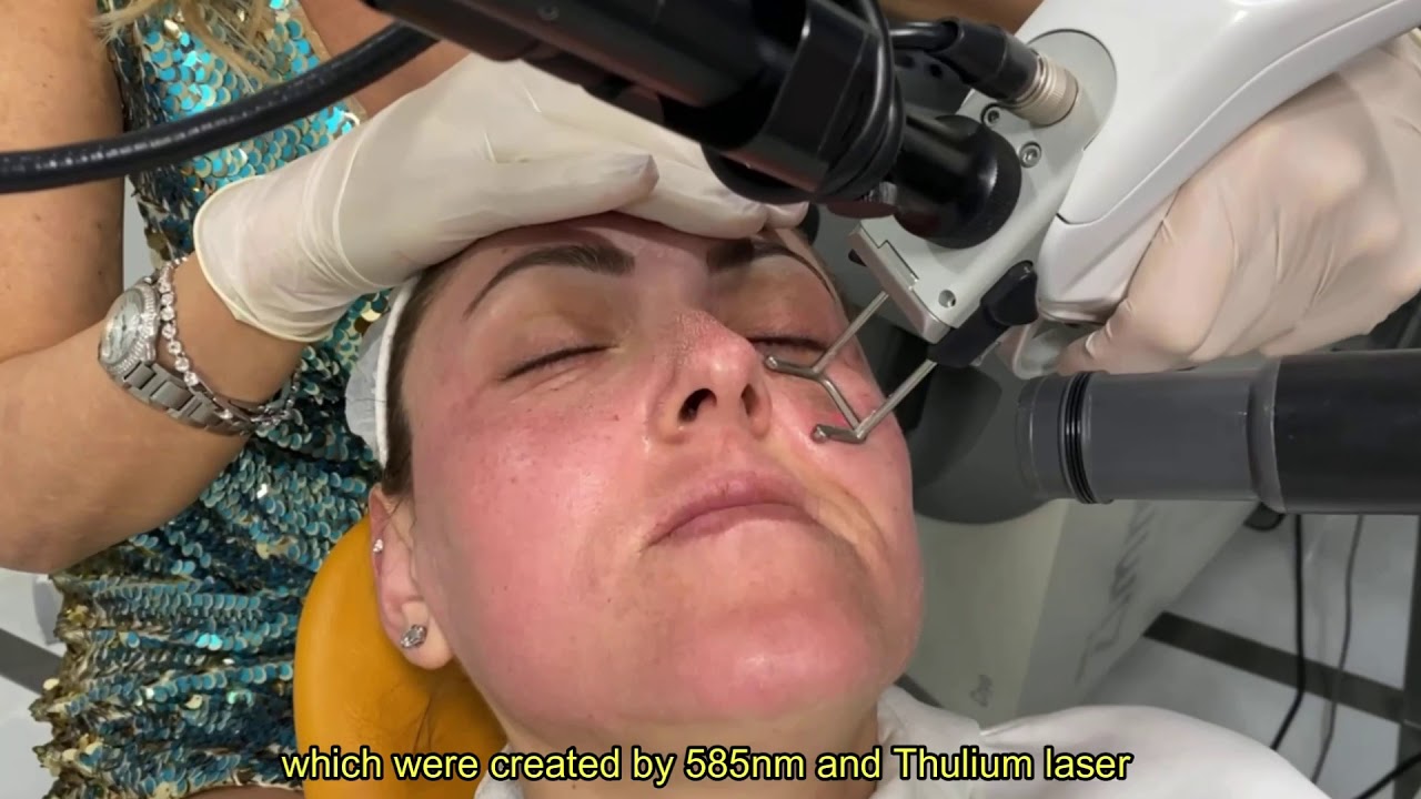 Dr. Nüket Eroğlu, 3D Baby Face