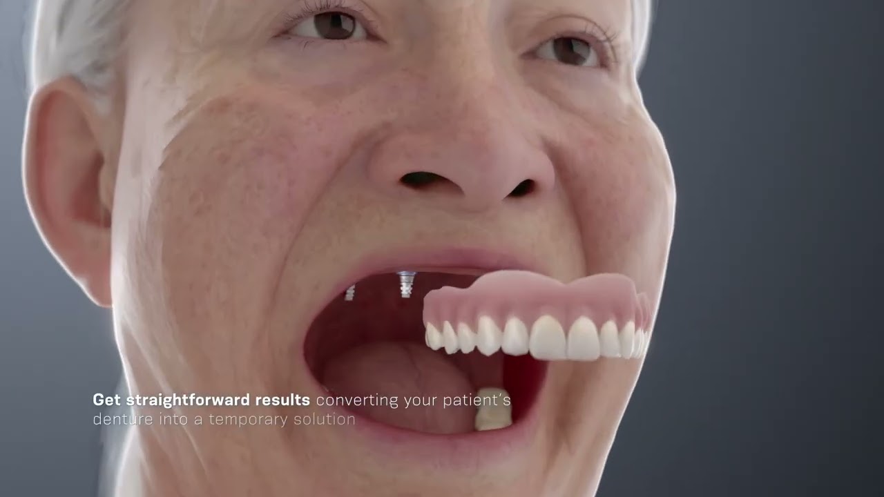 NeoArch video All-on-X with Neodent