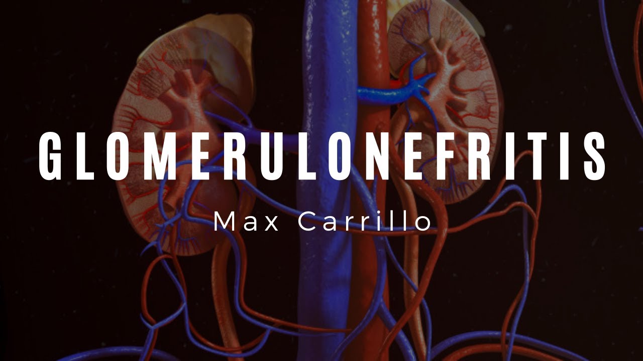 Glomerulonefritis - ENARM