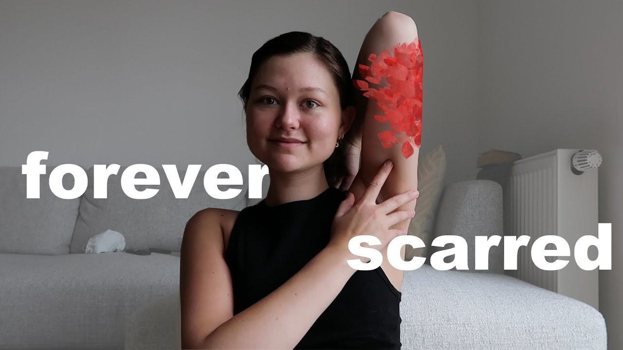 I Got My Cancer Tattoo || Cancer Journey