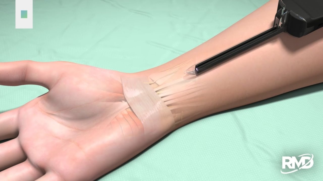VECTR Animation
