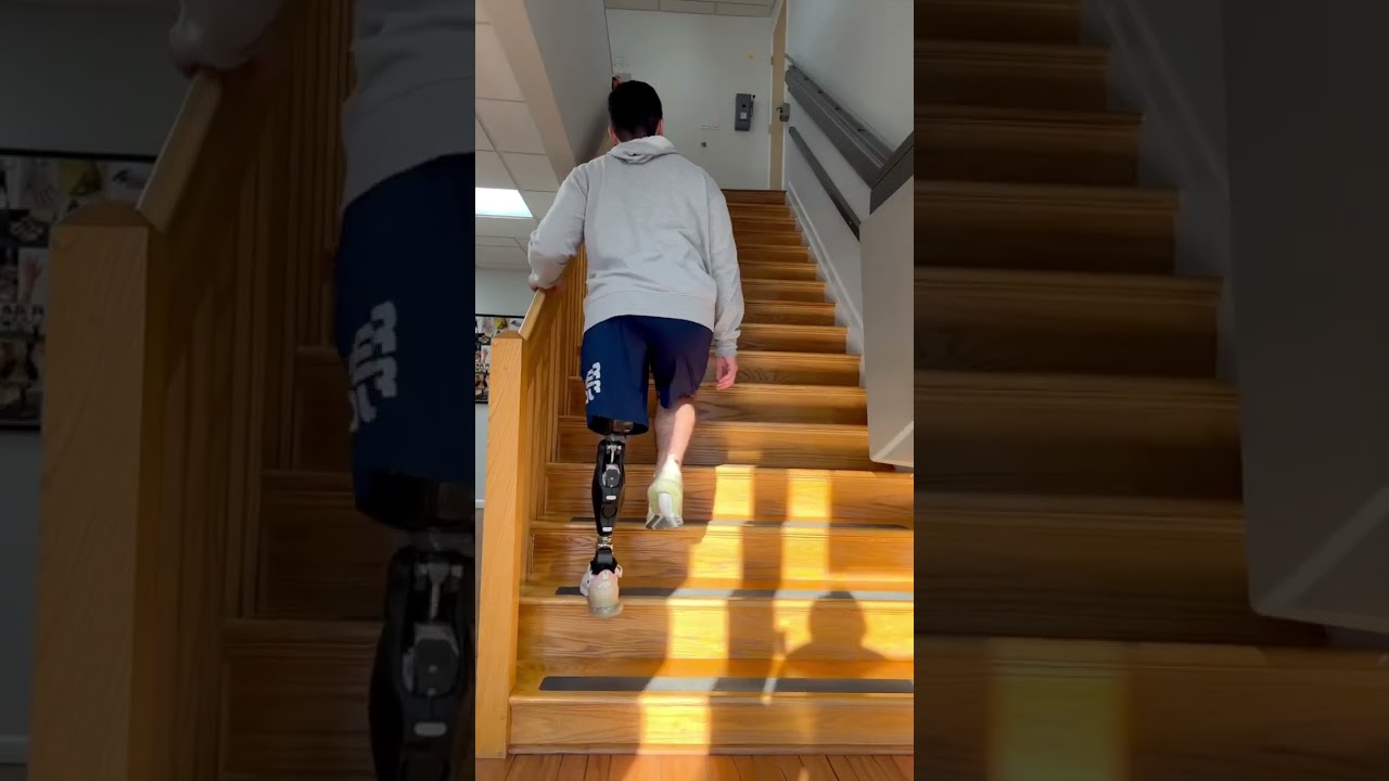 Anthony's Incredible Strides with the Ottobock X3 Knee Prosthesis | AK Amputee
