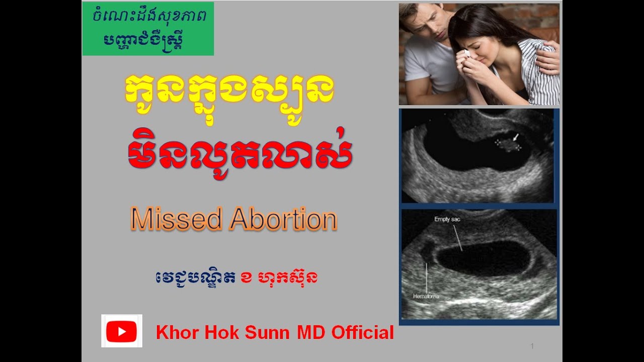 កូនក្នុងស្បូនមិនលូតលាស់ /Missed Abortion l Khor Hok Sunn MD Official