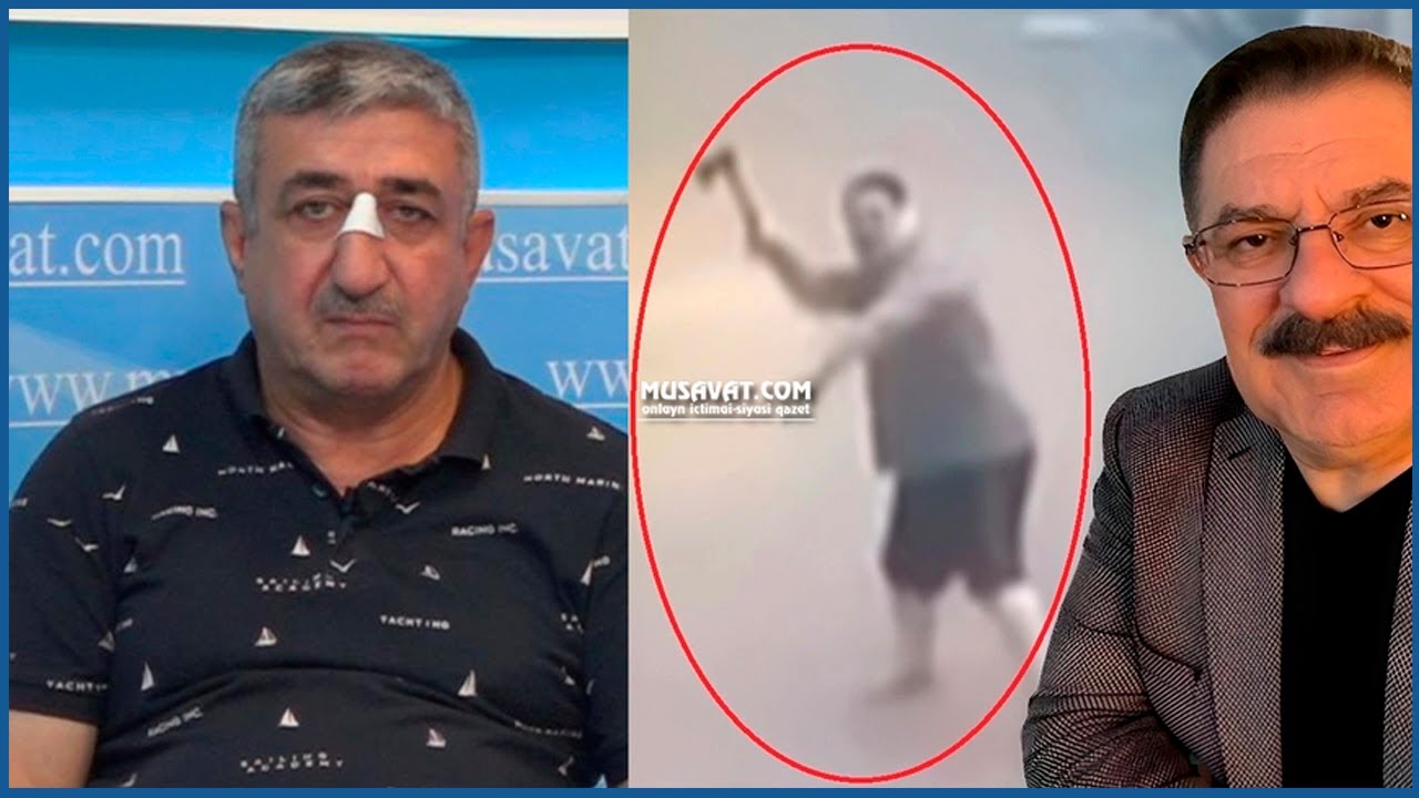 Ağadadaş Ağayevin balta atdığı gözətçi CANLI EFİRDƏ! Sensasion iddialar, şok gerçəkliklər!