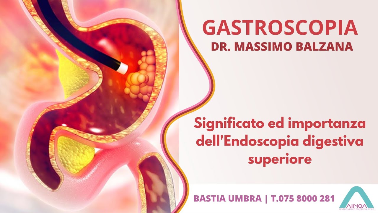 Significato ed importanza dell'Endoscopia digestiva superiore || Dr. Massimo Balzana