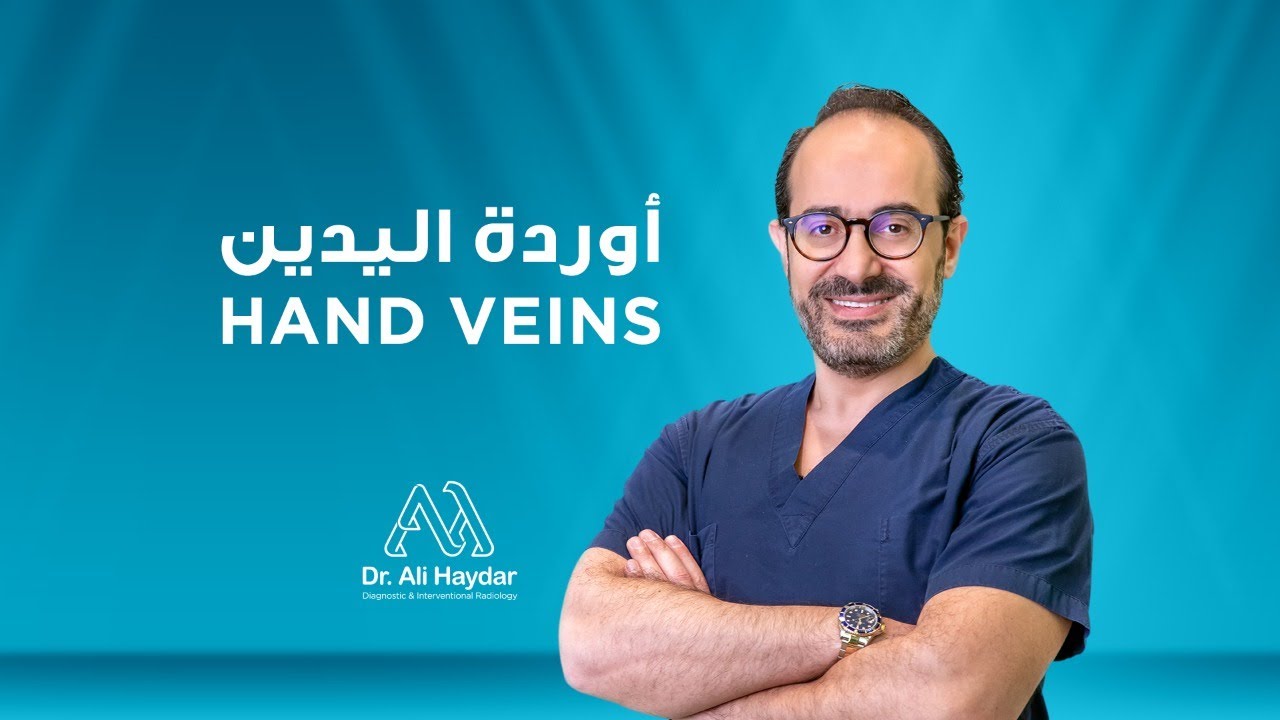 Hand Veins Treatment | Dr. Ali Haydar | علاج أوردة اليد