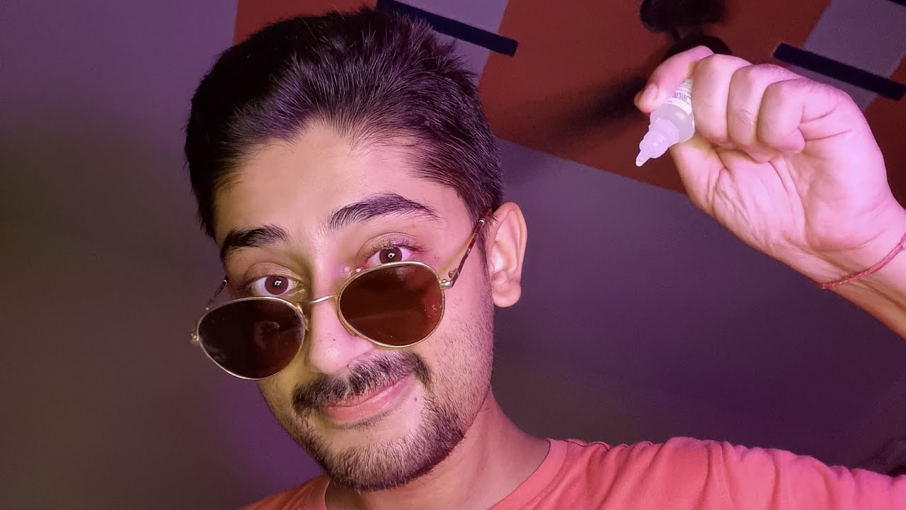 ASMR Gently Taking Care of ur Eye 👁️ (I have eye-flu!)🩸🔥 Personal Attention Video