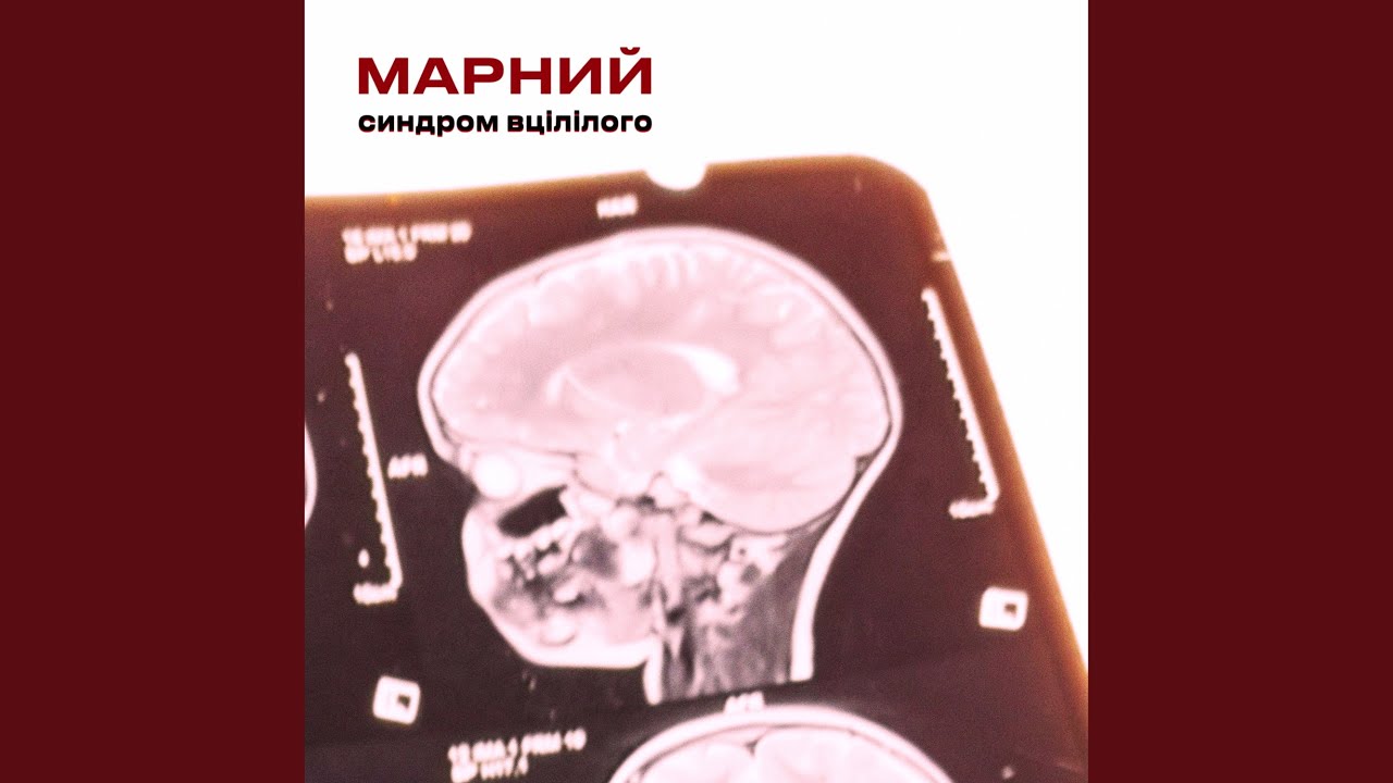 Синдром вцілілого