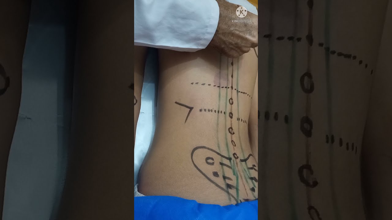شرح تقسيم فقرات العمود الفقري و العلامات المميزة و الشبابيك الخلفية للأعضاء _ تسجيل 2