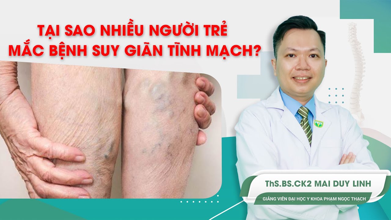 Tại sao nhiều người trẻ mắc bệnh suy giãn tĩnh mạch? ThS.BS.CK2 Mai Duy Linh