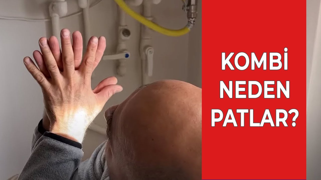 Kombi Neden Ses Yapar, İnler, Kendini Kötü Hisseder ve PATLAR?