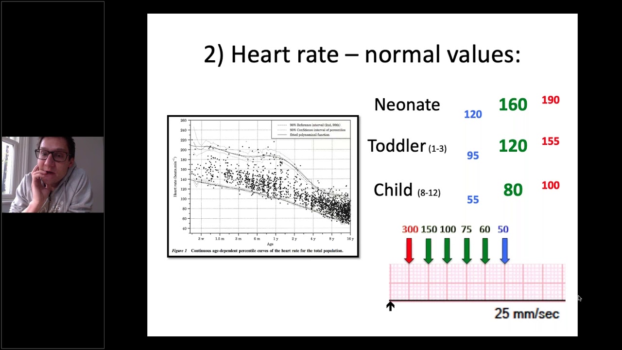 ECG Paediatric - Dr Regan 16Apr2020