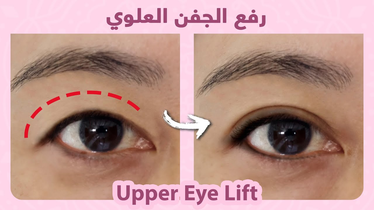 How to naturally lift droopy eyelids