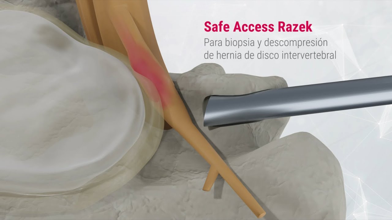 Safe Access