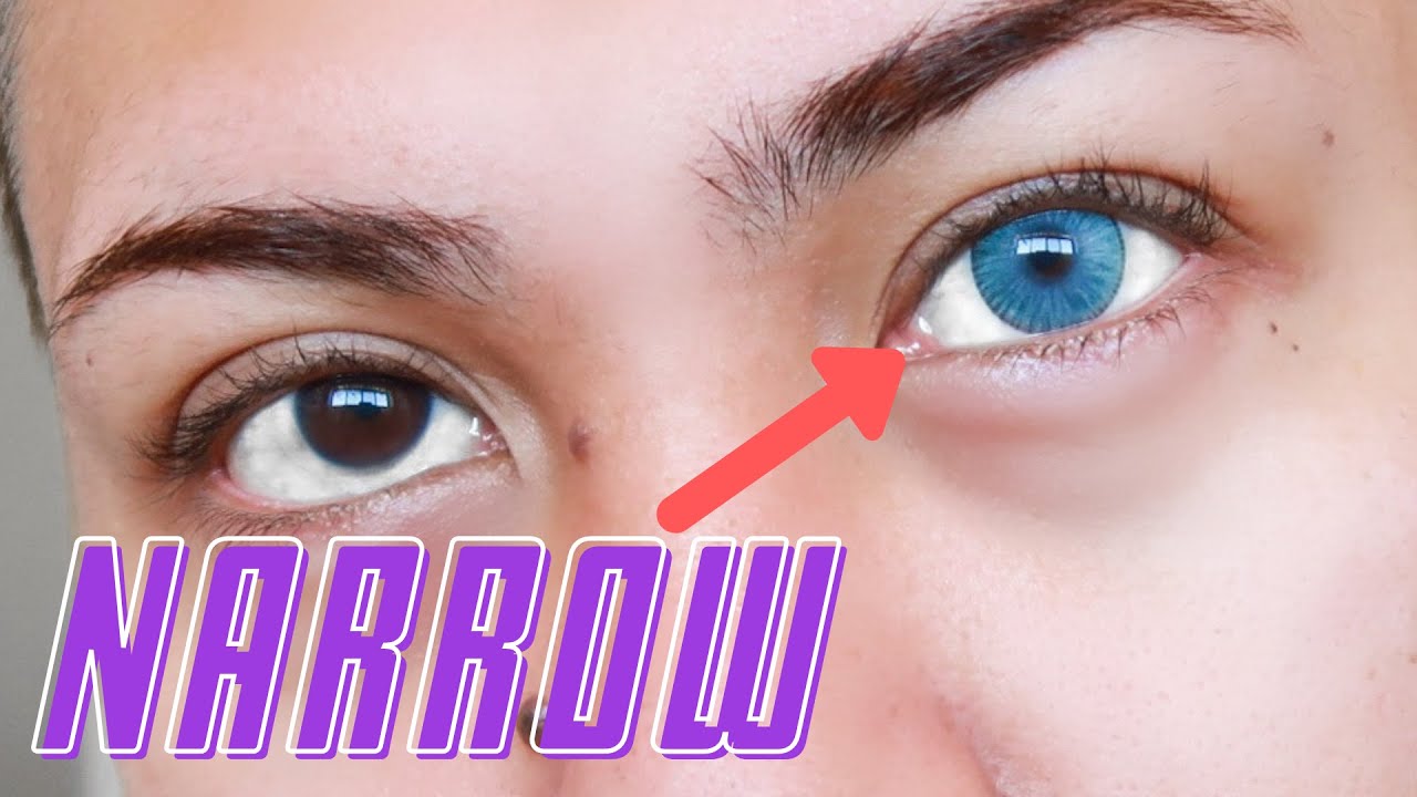 Uris Arctic Blue Lenses on Dark Brown Asian Eyes