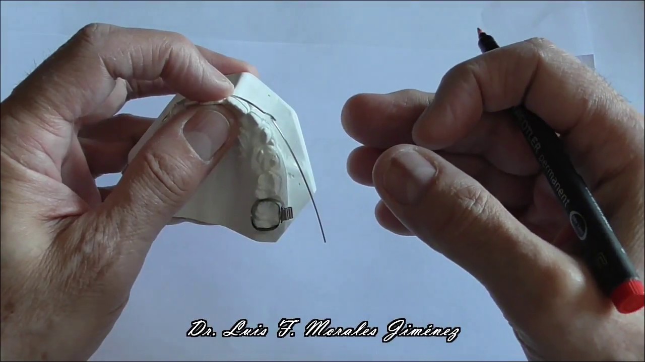3 ARCO UTILITARIO DE RETRUSION DE RICKETTS