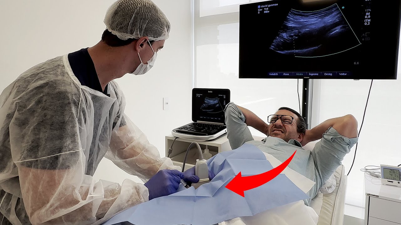 Apliquei ÁCIDO hialurônico no MEU PRÓPRIO QUADRIL! Veja como foi! 😱😱