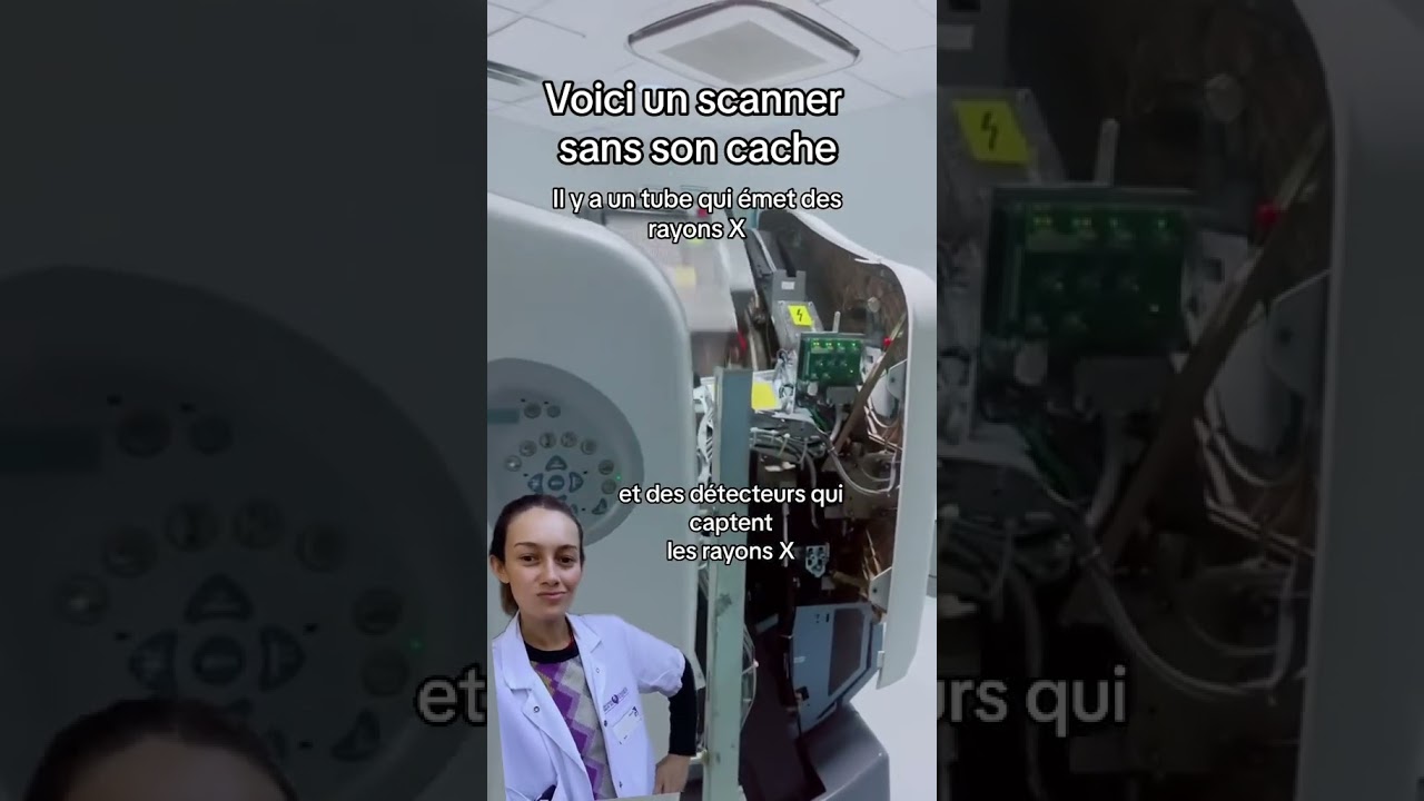 &Ccedil;a tourne vite &agrave; l&rsquo;int&eacute;rieur du scanner ! 🩻😳
