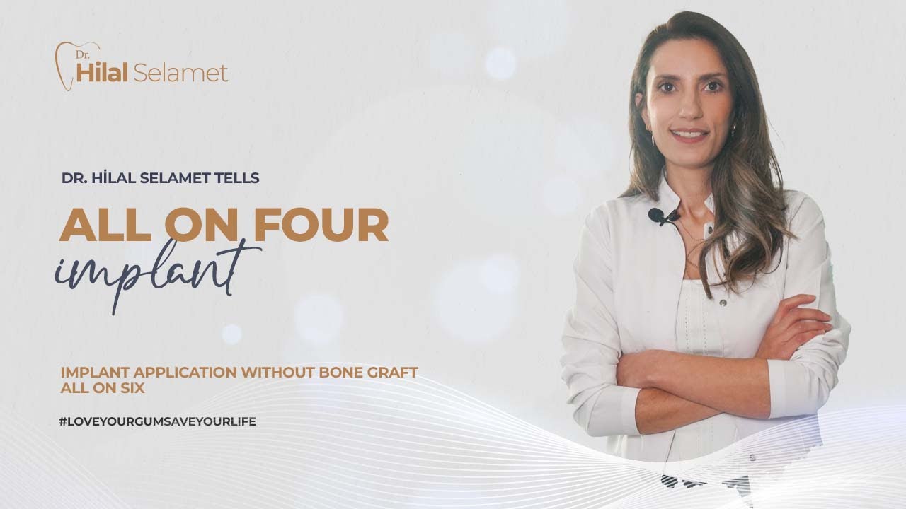All On Four Implant I Implant Application Without Bone Graft I All On Six