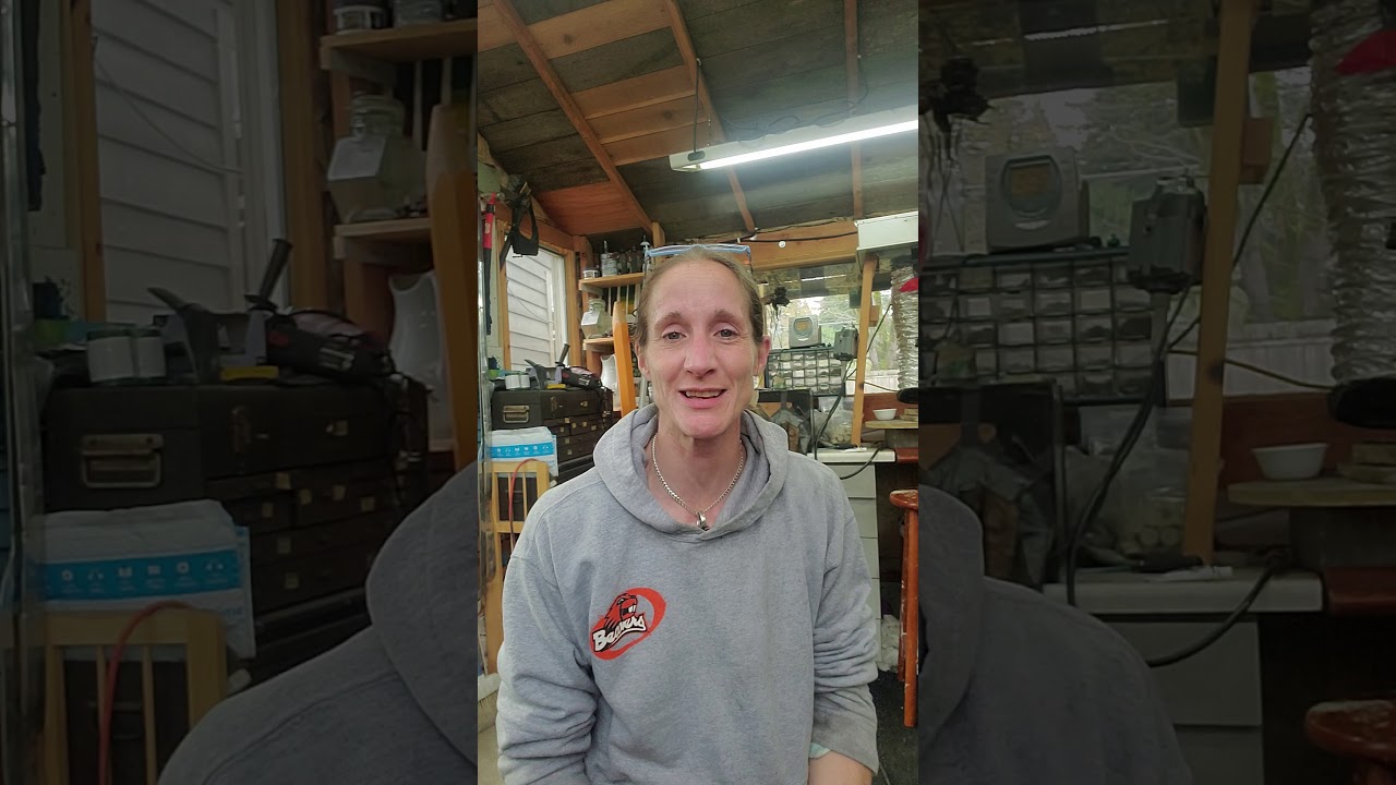 10 Years, Recovery from Neck Fusion / Anterior cervical discectomy surgery C3 C4 C5