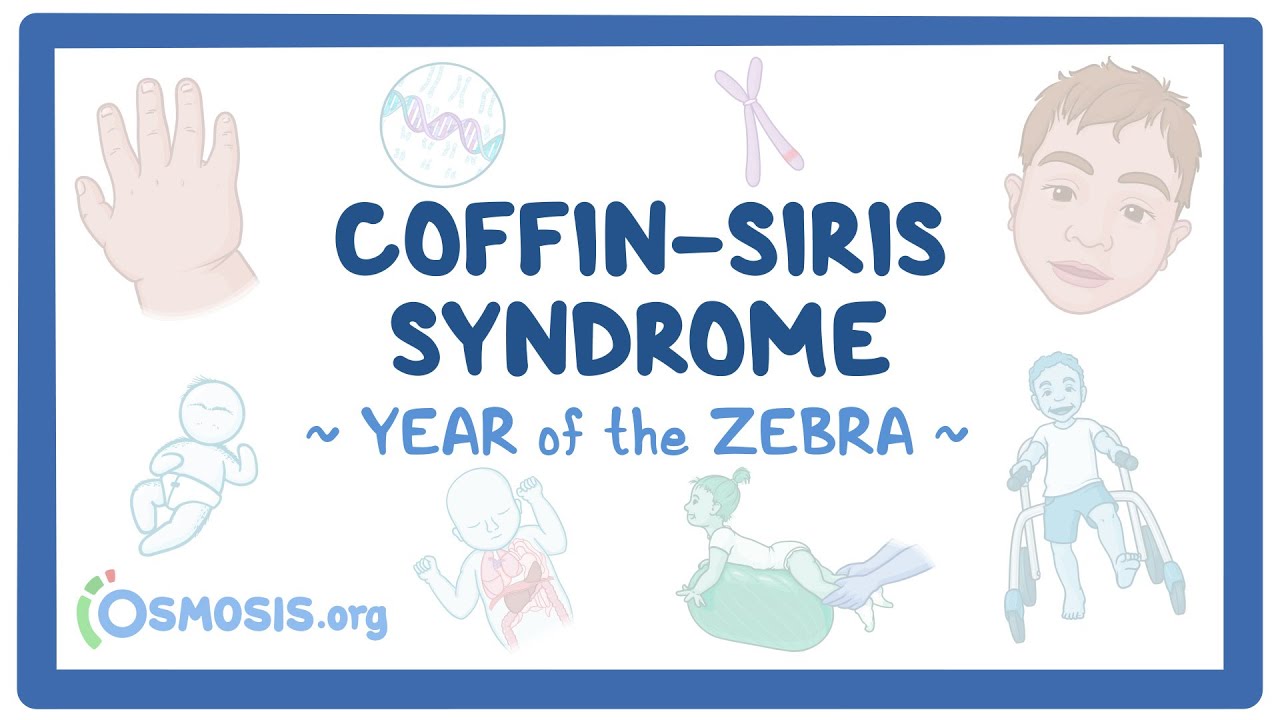 Coffin-Siris syndrome (Year of the Zebra 2025)