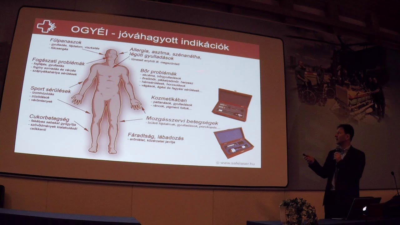 Rózsa Tamás: Safe Laser a lágy lézerek új generációja
