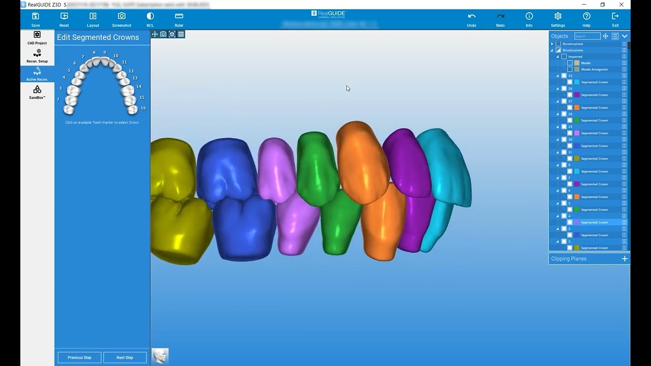 RealGUIDE Software:  Custom Teeth Library