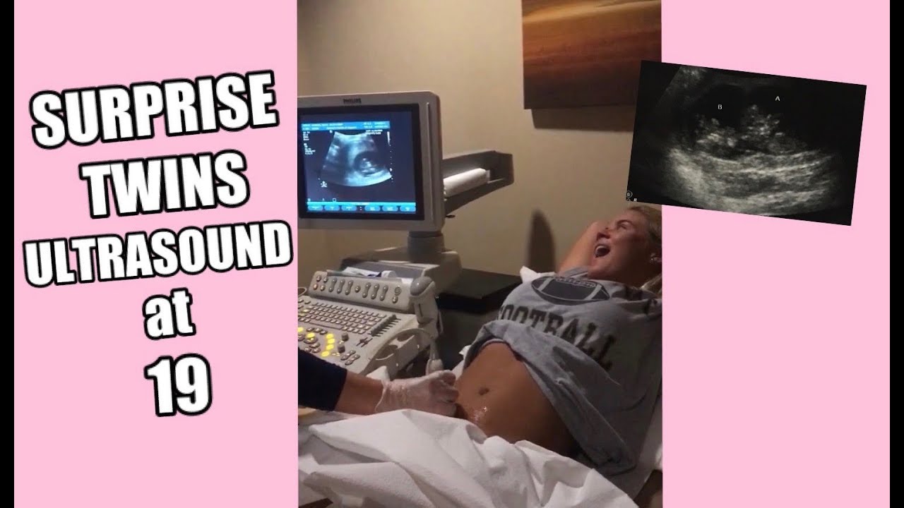 my surprise twins ultrasound - raw reaction