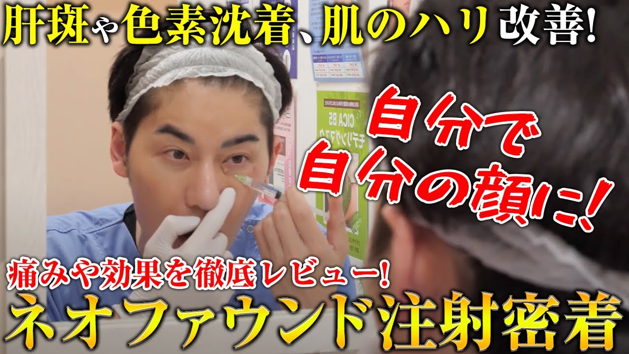 セルフネオファウンド注射！痛みやダウンタイムなど全てお見せします！
