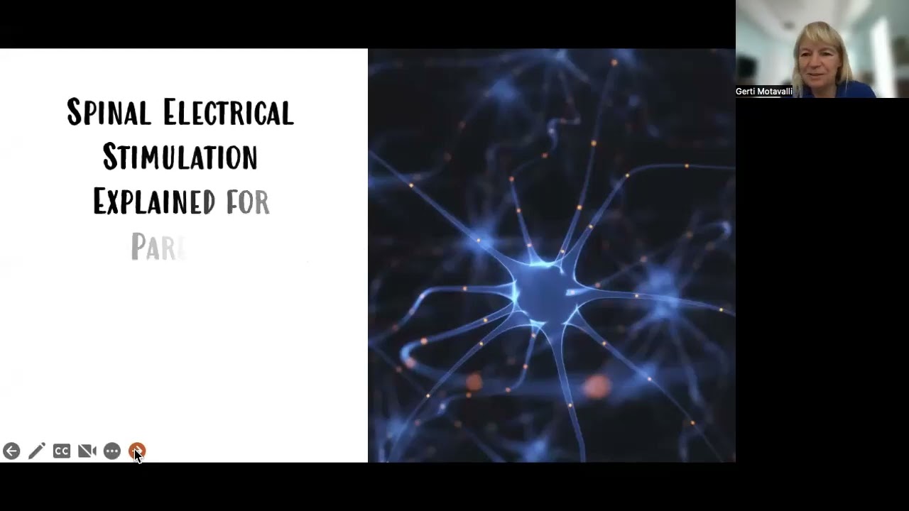 Spinal electrical stimulation for children with spina bifida explained for parents