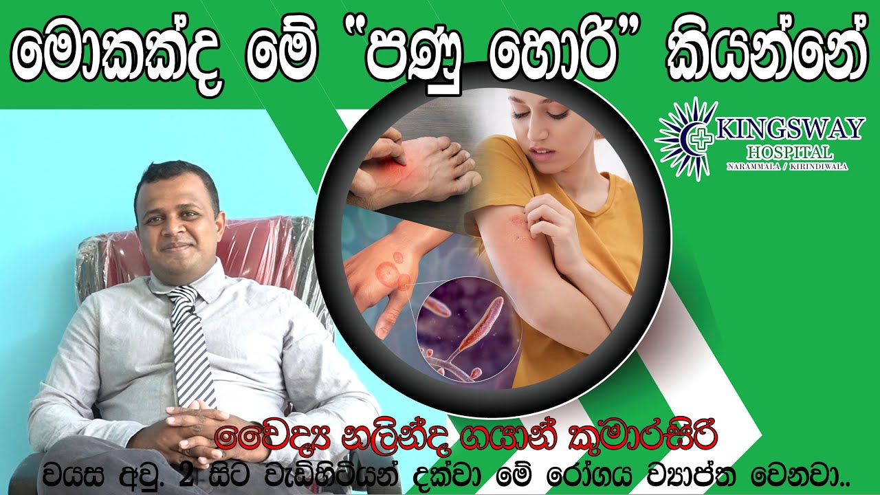 මොකක්ද මේ පණු හොරි කියන්නේ.. වෛද්‍ය නලින්ද ගයාන් කුමාරසිරි - කිංග්ස් වේ රෝහල. Mokakda me Panu Hori