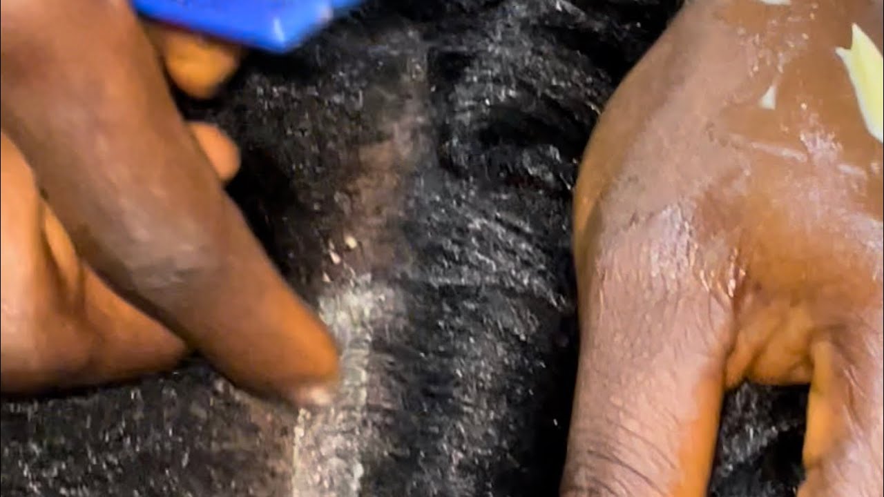 ASMR Greasing scalp, Dandruff check and chewing gum. Satisfying