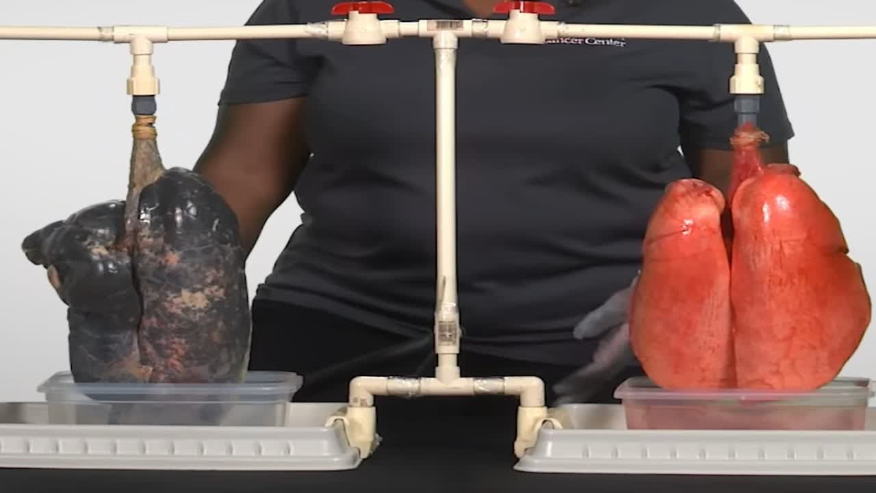 一个视频让你戒掉吸烟（吸烟者的肺与正常人的肺对比）