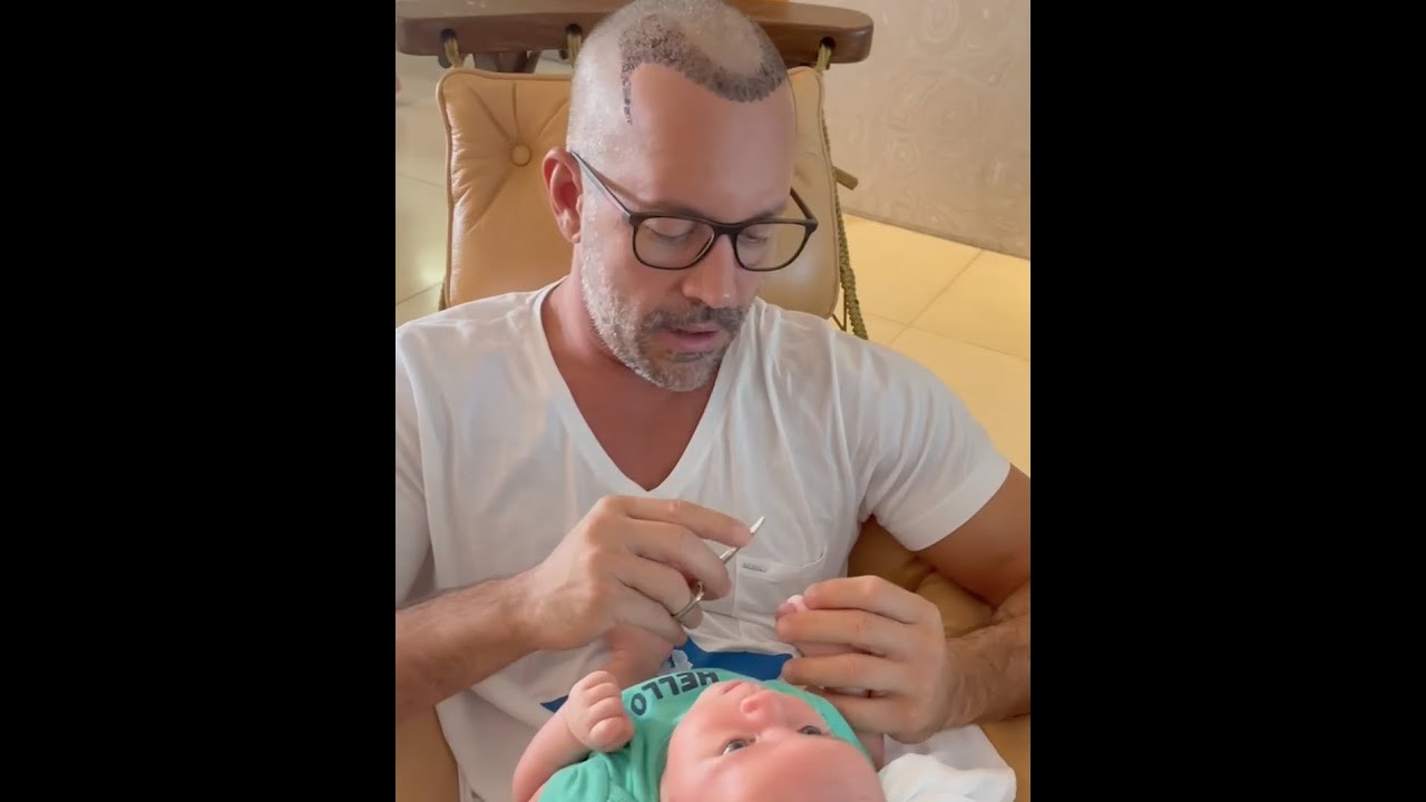 Dia a dia pós transplante capilar do Malvino Salvador | Mais Cabello