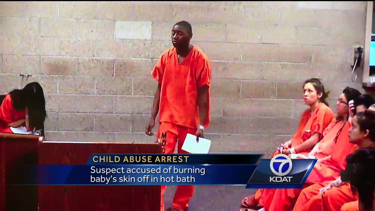 VIDEO: Man accused on burning baby's skin off in bath